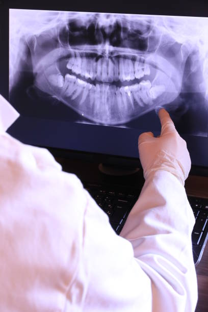 Best Emergency Dental Extractions in El Jon, CA