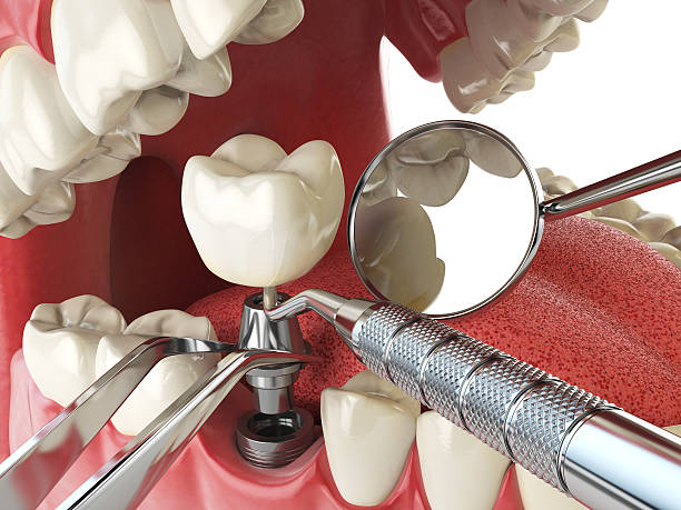 Best Weekend Emergency Dentist in El Jon, CA